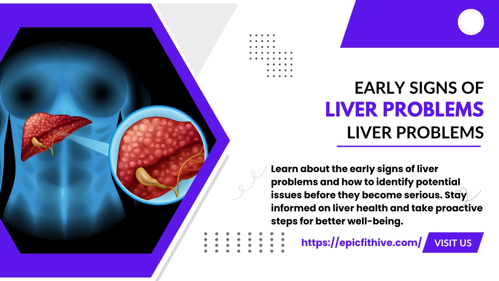 Read more about the article Early Signs of Liver Problems You Should Never Ignore